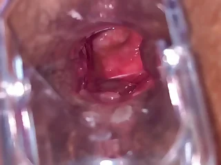 Anal Vision Reflector